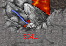 vvc2JFw.png